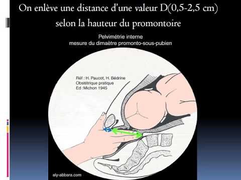 GYNECOLOGIE Examen du bassin obstetrical