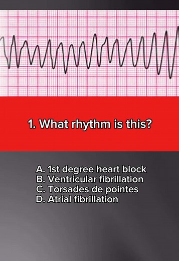 Challenge Yourself with This ECG/EKG Quiz