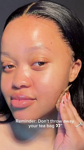Using Tea Bags for Skincare: Simple Home Remedies