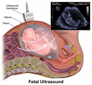 Signs of Fetal Distress During Pregnancy and Delivery