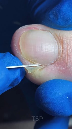 1.5M views · 16K reactions | Toenails smooth and shiny ✨ | Pictures of Art | Facebook