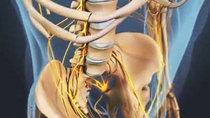 15K views · 229 reactions | Bone spurs can cause symptoms of...