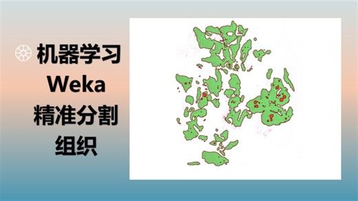 weka精准分割肿瘤/间质、胰岛/胰腺等复杂组织，实现高效批量分析