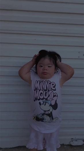 Discover Down Syndrome Awareness Facts