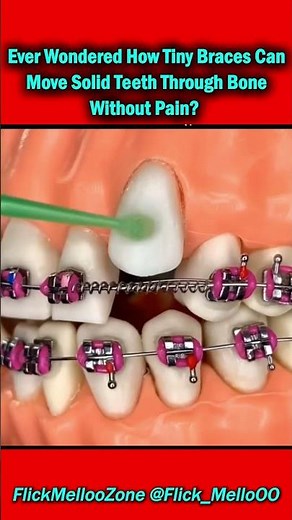 How Braces Move Teeth Through Bone Without Pain 😳 | The Science Explained