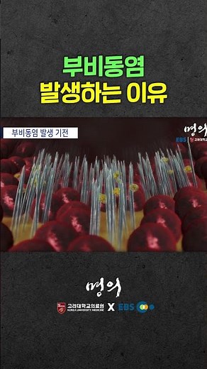 부비동염 원인과 주요 증상