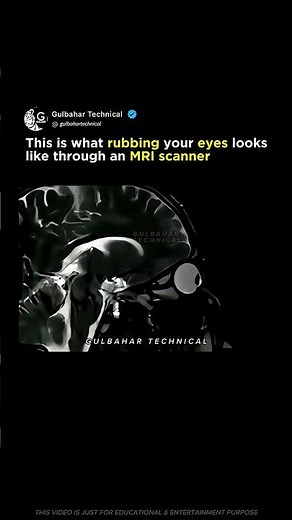 What Happens When You Rub Your Eyes Under MRI! 😳🧠