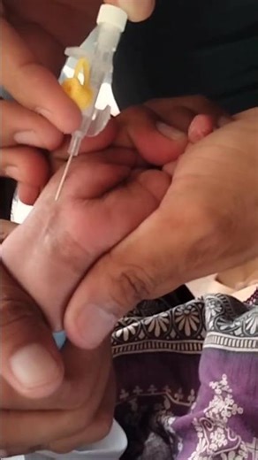 IV Line Insertion: Best Practices and Tips|How to Insert an IV Line: A Step-by-Step Guide #ivline