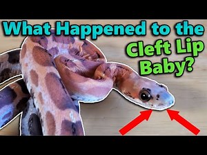 Cleft Lip Baby Update!!
