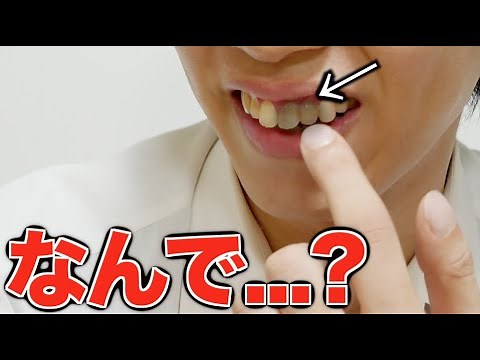 Regarding my front teeth continuing to turn black.