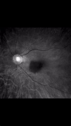 Regarding our new published article: How many color channels can we extract from a single color fundus image? 👀🔍 The answer might surprise you! From RGB to CMYK and beyond, each channel offers unique insights into retinal structures, potentially revealing subtle details often overlooked. There’s still so much untapped information within these images, just waiting to enhance our understanding of retinal diseases.. Can’t wait to share our new findings with you all!!