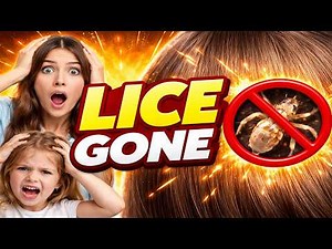 How to Remove Lice Eggs from Hair Permanently at Home (100% Effective)