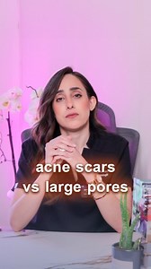 2K views · 20 reactions |  Open Pores vs. Acne Scars!  Open pores...