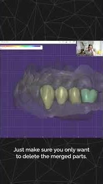 exocad Training Session - Seth Potter