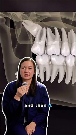What’s normal after wisdom teeth surgery?