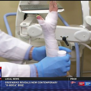 Hand Injuries—Splints as a treatment Option