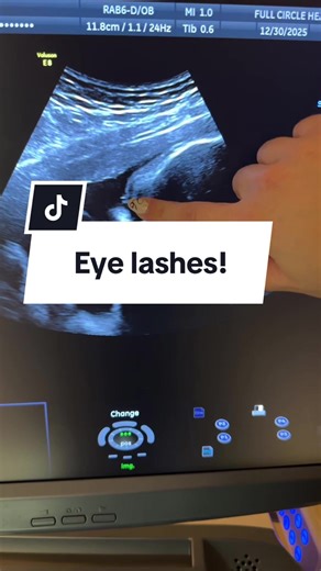 Captivating 3D Ultrasound at 33 Weeks Pregnant