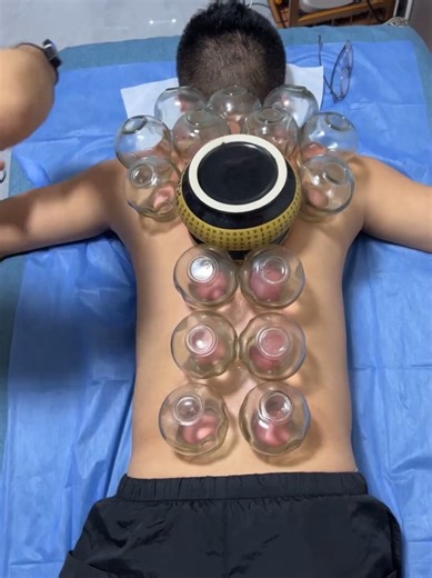 ASMR Back Massage for Ultimate Relaxation