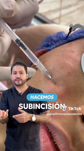 Tratamiento efectivo para cicatrices en dermatología