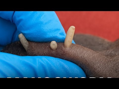 Puppy Covered in Mangoworms Gets a New Life ​‪@VetClinicGambia‬ | Dog Maggots | Maggot removal #worms