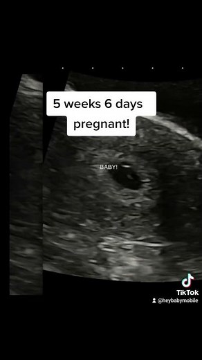 5 weeks 6 days pregnant! Baby is 3 mm- check out the ultrasound!