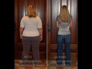 HCG Protocol Before and After - Goal