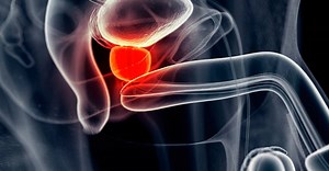 Câncer de próstata: as novidades que levam à cura da doença | Letra de Médico