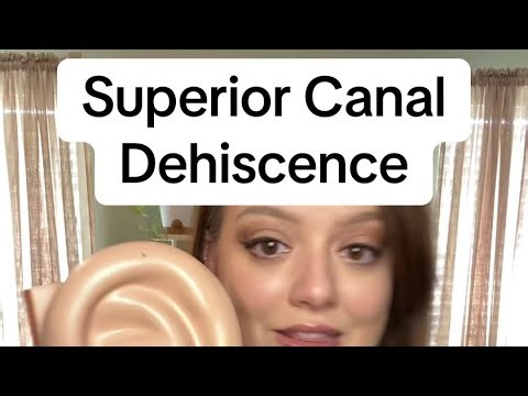 All about Superior Canal Dehiscence Syndrome
