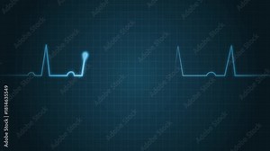 Heartbeat Line Wave Signal Animation with Animated ECG Pulse and Continuous Flow for Health Projects