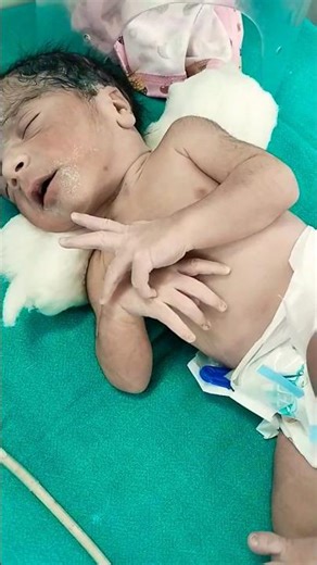 Newborn baby Just after Birth 🥰 Check O2 level 🎚️