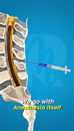 Do you know there are 4 types of anesthesia !!1