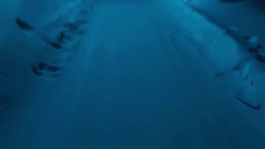 Understanding Depression and Its Impact