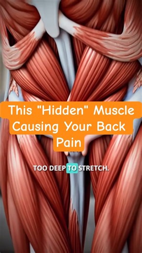 This "Hidden" Muscle Causing Your Back Pain (QL Release) #shortsvideos #backpain #QLmuscle