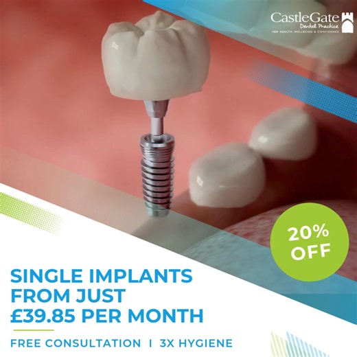 🎉 20% OFF Dental Implants Extras at Castle Gate Dental! 🎉 Take advantage of our exclusive implant package with huge savings and bonuses included: ✨ FREE Whitening Pre-Treatment (worth £450) ✨ FREE 3x Hygiene Appointments – before, during & after (worth £278.40) ✨ FREE Bite Guard at end of treatment (worth £225) ✨ FREE Consultation CBCT Scan (worth £150–250, deducted from treatment cost) 💰 Special Pricing (After 20% OFF): ✔ Single Implant – £1,196 (was £1,495) ✔ Implant Bridge (3 Unit) – £4,95