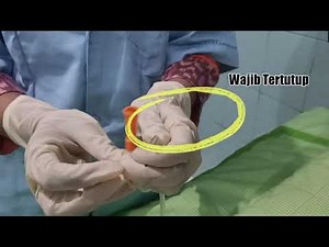 Procedure for Providing Nutrition Through a Nasogastric Tube (NGT)