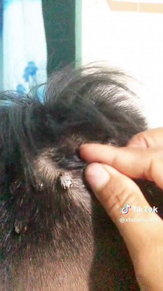 oh my god, the ticks still haven't been cleared from this guy's head #ticks #foryou #fyp