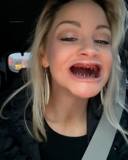 4.9M views · 22K reactions | This is how I eat with dentures 醴 | FOODbible | Facebook