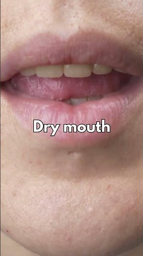 PANTOPRAZOLE💊 (PROTONIX/PANTOLOC) SIDE-EFFECTS YOU NEED TO KNOW!