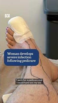 Woman 'almost loses toe' after nail salon visit | ABC NEWS