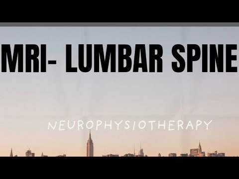 MRI- Lumbar Spine #mri#lumbar #backpain#radiology #physiotherapy #spinalcordinjury #spinalrehab#pain