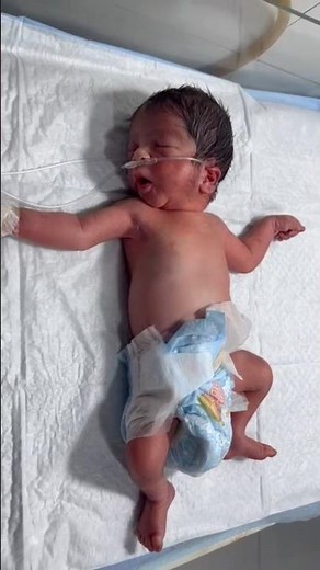 Newborn Baby Grunting 😮 Is It Normal? Watch & Learn