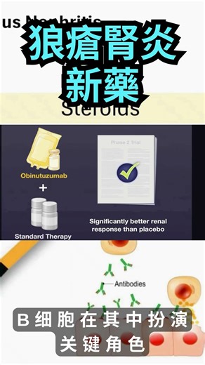 狼疮性肾炎的免疫治疗