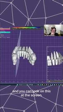 exocad Training Session - Seth Potter