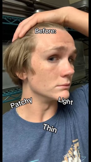 Emity - Lookmaxxing | Most guys waste years improving the wrong things. They train hard… but ignore posture. They buy skincare… but don’t know their real... | Instagram