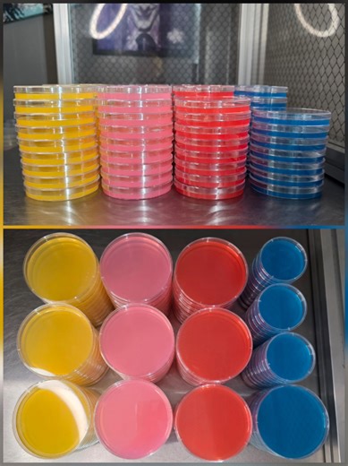 🧫Some of my recent agar plates 😊 🌈✨ Fresh poured to order agar plates ready for your next mycelium adventure! Check out these vibrant colors in action – perfect for isolating cultures, spotting contaminants early 🔍, or just making your lab setup pop! 🎨🧫 Available in your choice of color 🌈, with sizes: • 60mm (compact and cute!) • 90mm (standard petri perfection 👌) Sterile 🧼, and ready-to-inoculate 💉. Grab yours here 👉 https://needlejuicefungi.etsy.com #Mycology 🔬 #AgarPlates 🧫 #Mush