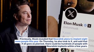 Elon Musk Sees Millions Of People Having His Brain Chip Implanted In Next Decade After Second Patient Says 'Already Super Impressed' With Neuralink