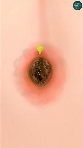 ASMR Navel Stone Removal 🤯 | Deep Belly Button Cleaning & Dirt Extraction Animation #shorts #asmr