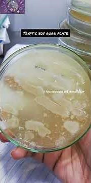 Microscopy | Microbiologist amd Microbiology