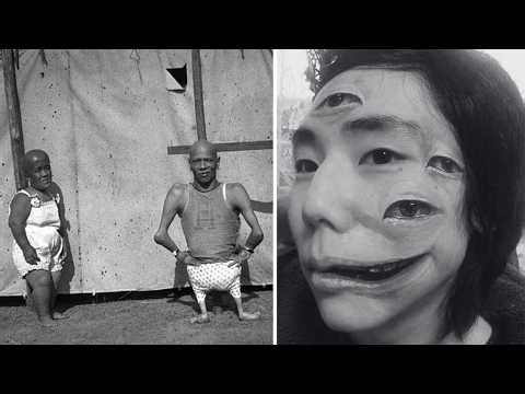 15 Strangest Circus Freaks You Won’t Believe Existed!