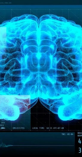 Why So Many People With ADHD Are Highly Intelligent